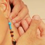 Agopuntura e Medicina Cinese